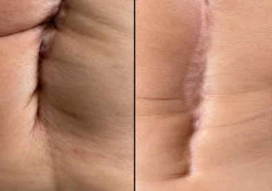 skin reset